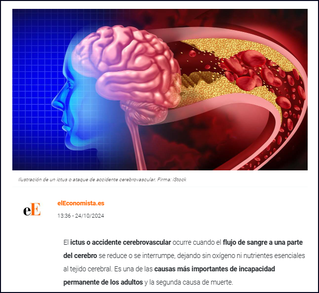 Aumentan los casos de ictus: s&iacute;ntomas y c&oacute;mo reducir el riesgo
