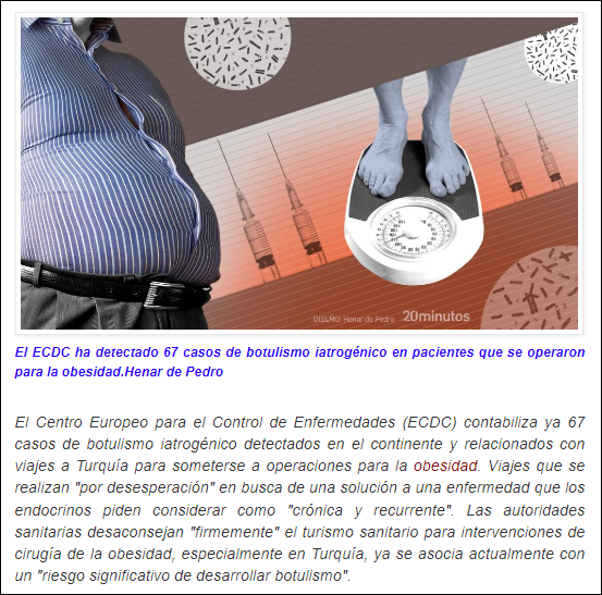  Los peligrosos tratamientos antiobesidad (67 casos de botulismo iatrog&eacute;nico en Europa)