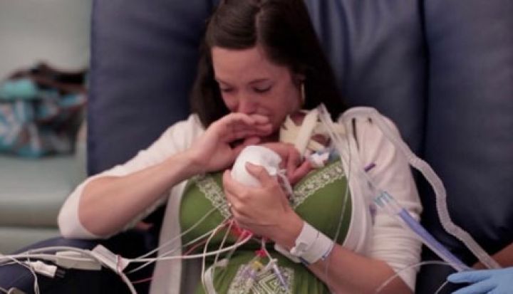 La historia del beb&eacute; prematuro que conmueve al mundo