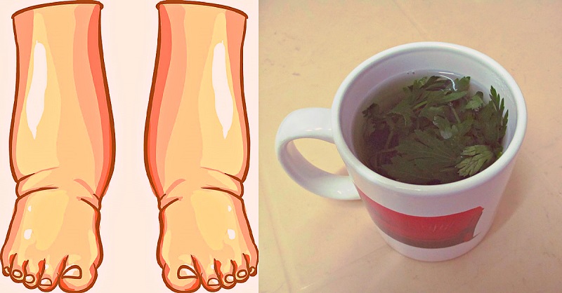 &iexcl;Este es, quiz&aacute;s, el m&aacute;s poderoso remedio natural para aliviar la hinchaz&oacute;n de los pies!