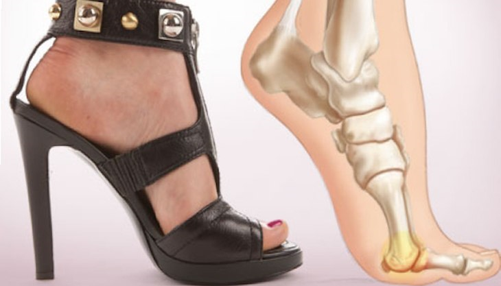 &iexcl;De ahora en adelante podr&aacute; usar tacos altos sin sentir dolor en los pies!