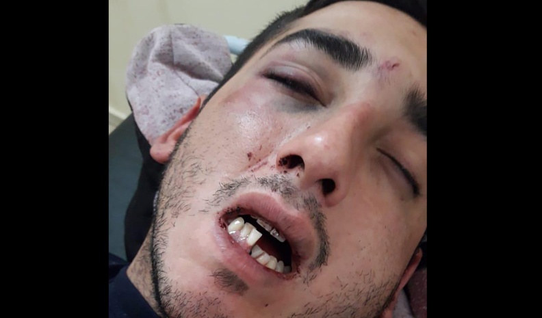4 polic&iacute;as suspendidos por romper la mand&iacute;bula a un joven