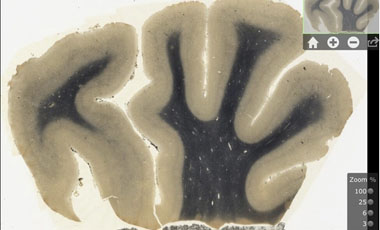 Crean aplicaci&oacute;n que permite ver el cerebro de Albert Einstein