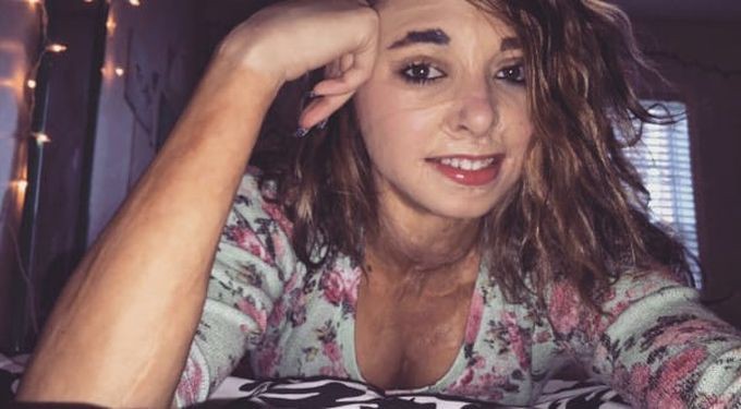  Venci&oacute; a la muerte y a las cr&iacute;ticas de mucha gente, ahora es toda una inspiraci&oacute;n