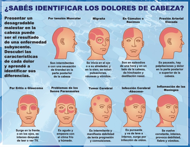 Se&ntilde;ales que no deben ser ignorados: C&oacute;mo reconocer un dolor de cabeza mortal.