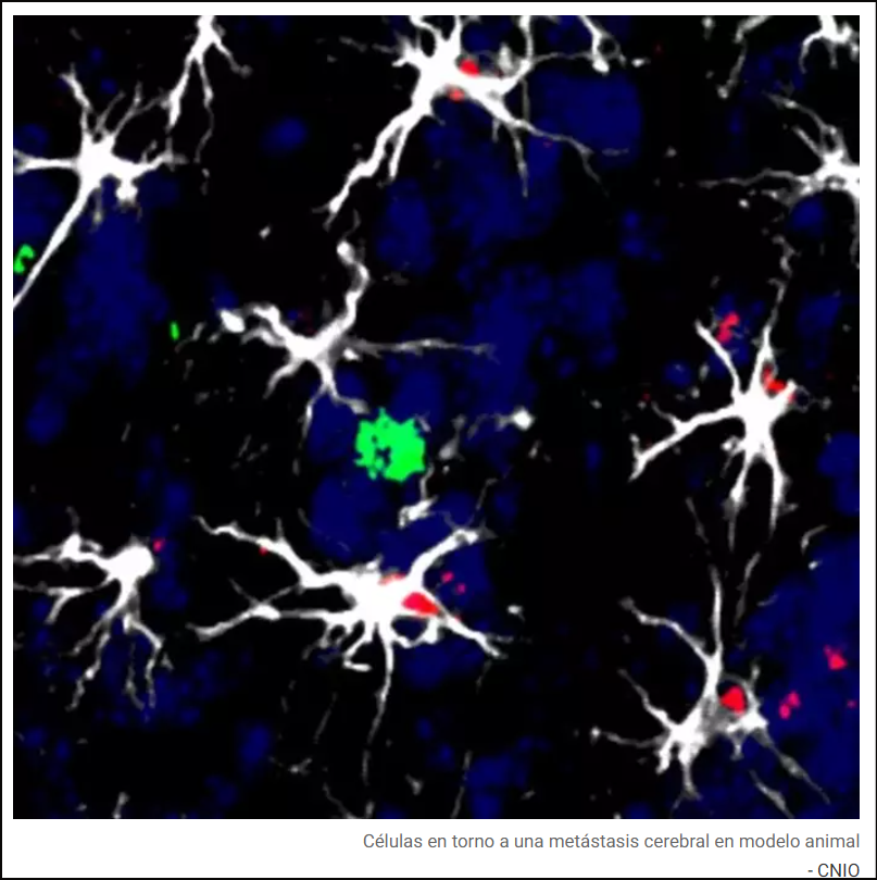  Identifican las c&eacute;lulas que facilitan la met&aacute;stasis cerebral