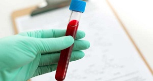 &iquest;Cu&aacute;les son los valores correctos de un  hemograma?