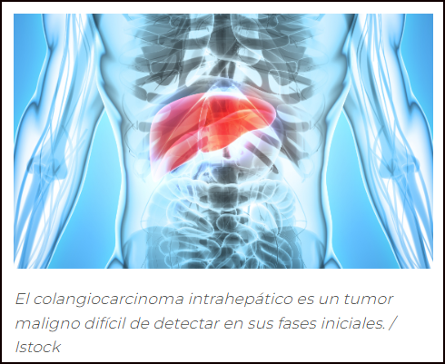 Nueva v&iacute;a para tratar un c&aacute;ncer de h&iacute;gado