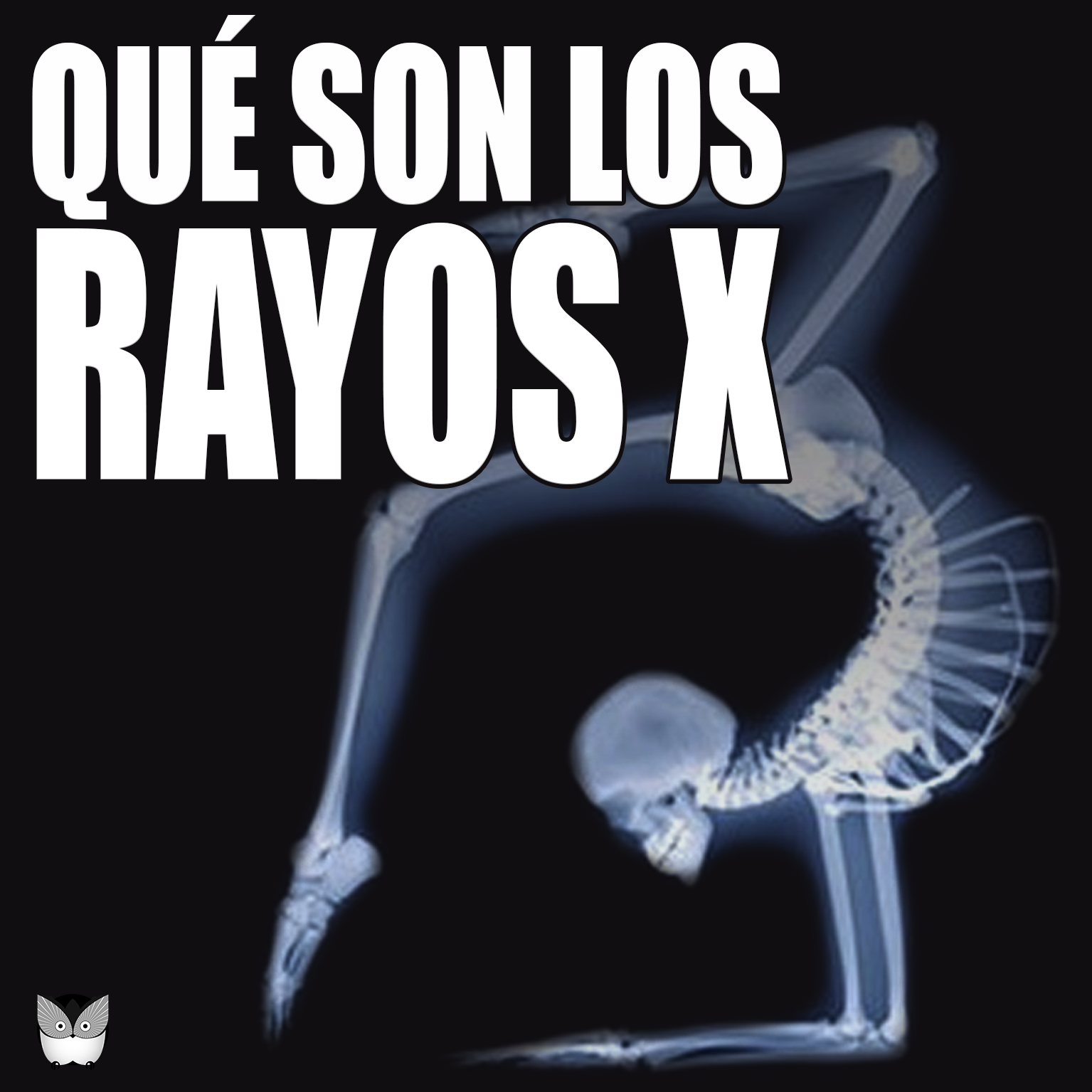 &iquest;QU&Eacute; SON LOS RAYOS X?