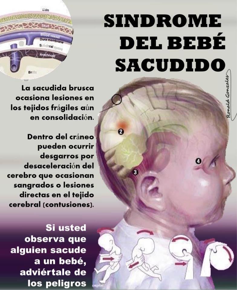 Sacudir a un beb&eacute; puede ser fatal
