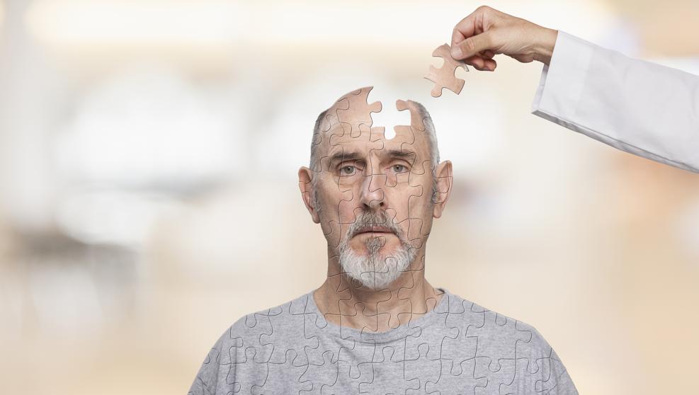 5 cosas que no sab&iacute;as sobre el Alzheimer