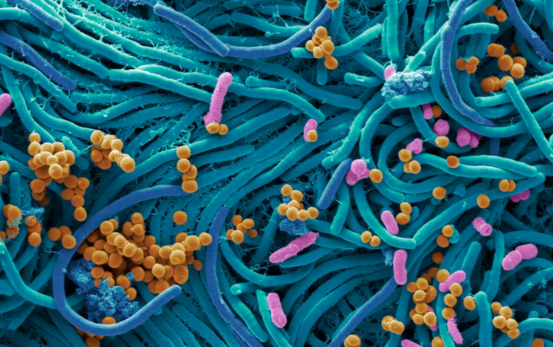 SUPERFICIE DE UN CELULAR PUEDE CONTENER  25 MIL 127 BACTERIAS