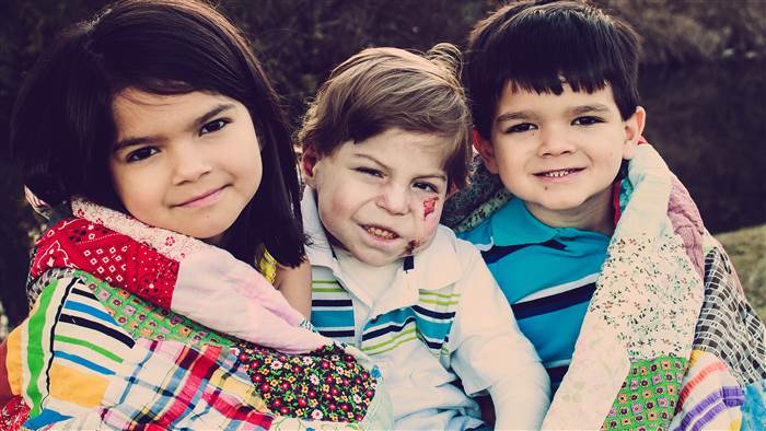 "Everyone loves him": Family adopts abandoned butterfly baby