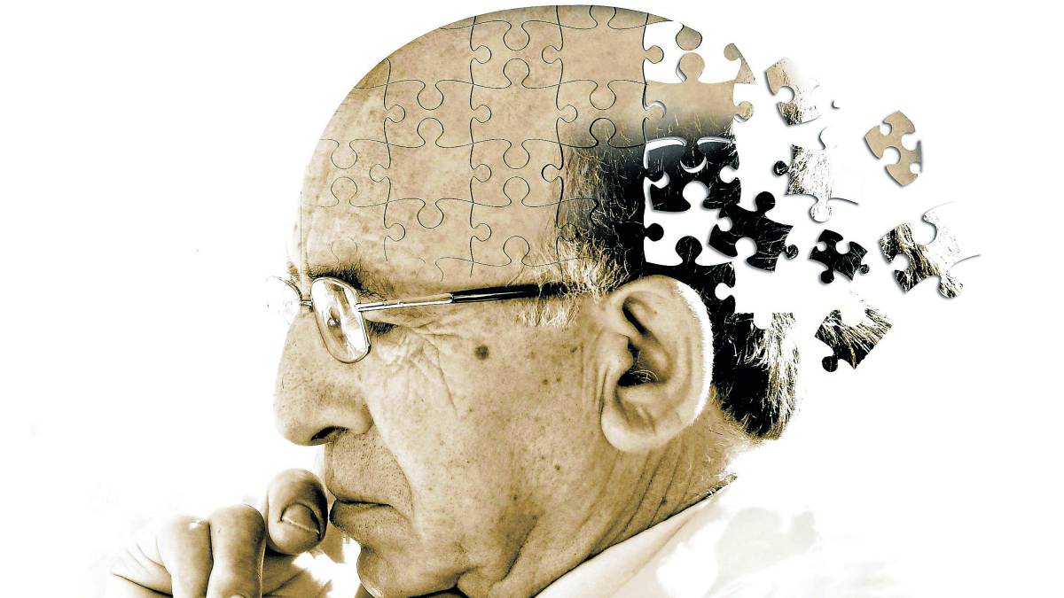 El Alzheimer podr&iacute;a ser una enfermedad transmisible seg&uacute;n estudios