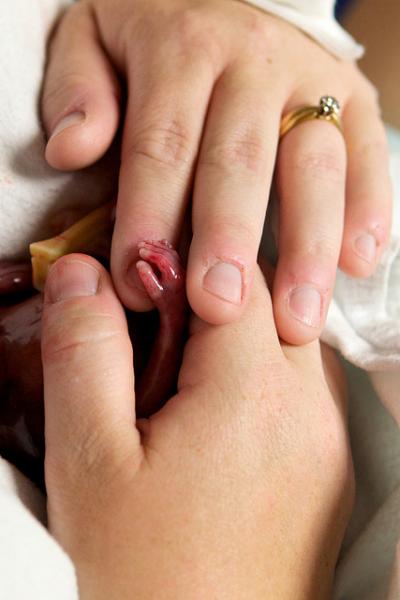 Beb&eacute; prematuro de 19 semanas vivi&oacute; algunos minutos y ha conmovido a millones de personas