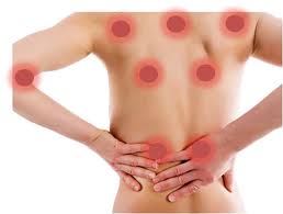 Ganoderma en la Fibromialgia (II)