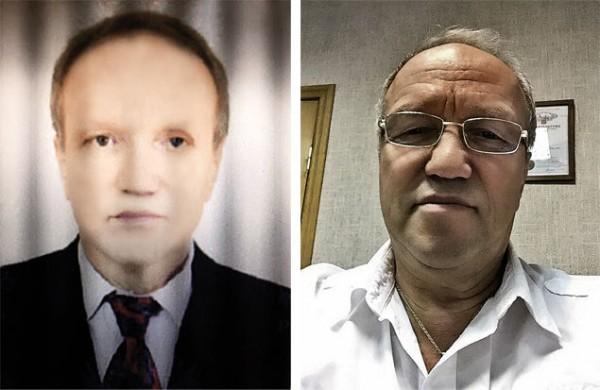 Russian man claims his skin has become darker after liver transplant from african-american Donor