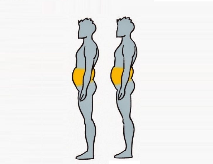 6 Tipos de obesidad, &iexcl;Mira cu&aacute;l es el tuyo y elim&iacute;nalo!