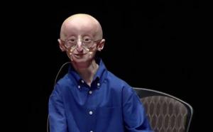 A los 17 a&ntilde;os, muri&oacute; Sam Berns, que sufr&iacute;a la enfermedad de Benjamin Button