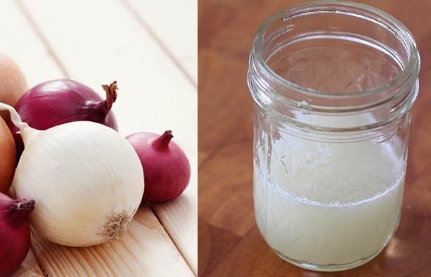 C&oacute;mo usar y preparar jugo de cebolla para crecer y prevenir la ca&iacute;da del pelo