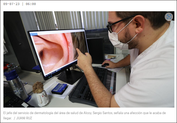  Teledermatolog&iacute;a     un gran y sencillo avance