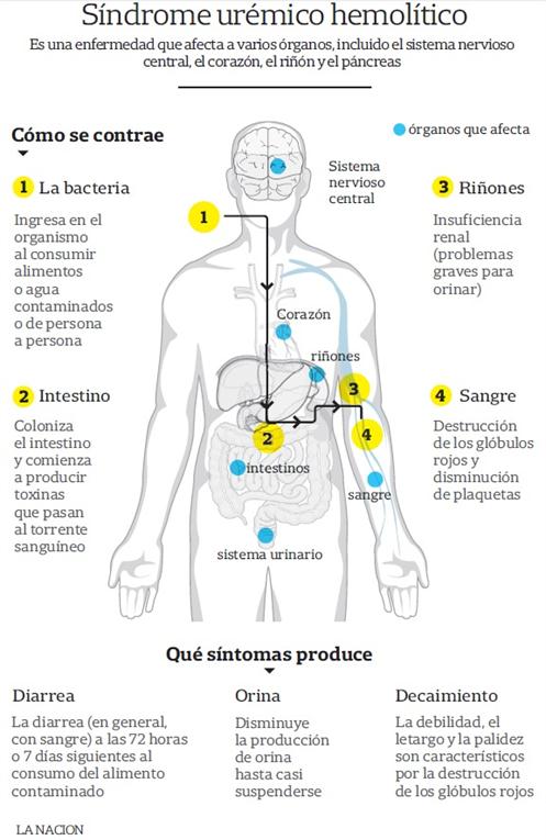 una-enfermedad-de-transmision-alimentaria