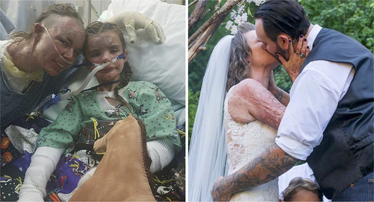 Mujer sufre quemaduras por salvar a una ni&ntilde;a, poco despu&eacute;s el padre de esta le pidi&oacute; matrimonio 