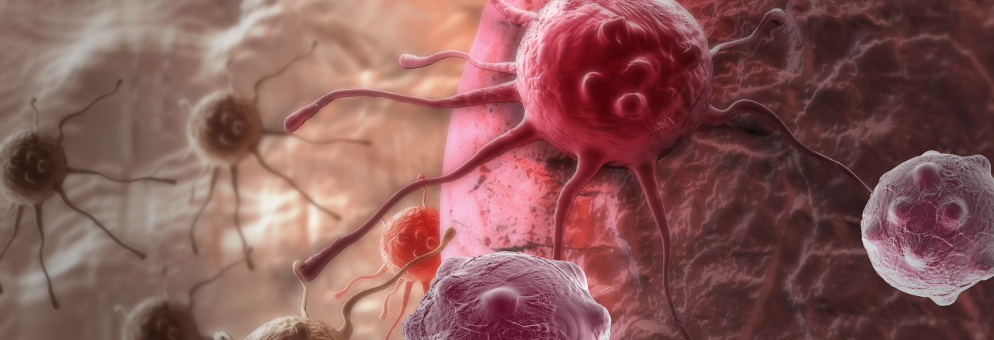 Las se&ntilde;ales de c&aacute;ncer que los hombres dejan pasar
