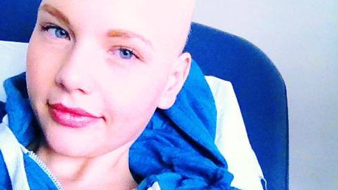 Tiene c&aacute;ncer, se qued&oacute; pelada y sigue modelando