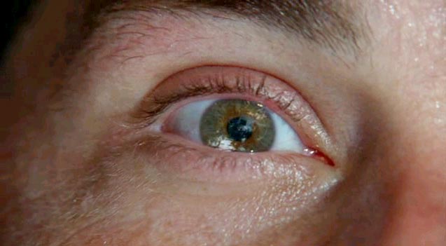 Este hombre se despert&oacute; ciego por un error que muchas personas cometen en las noches