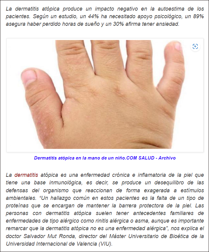  Esos molestos picores que con sus rojeces aparecen por todo el cuerpo: &iquest;Eso que es?