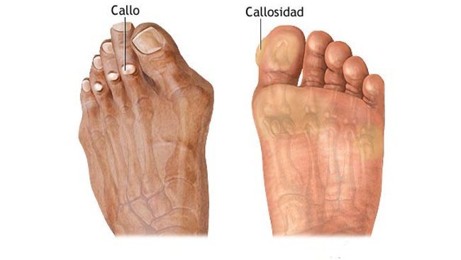 De esta manera se reflejan los conflictos emocionales en los pies