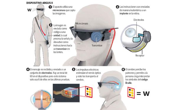 Implante en la retina permite a invidente leer en Braille con la vista