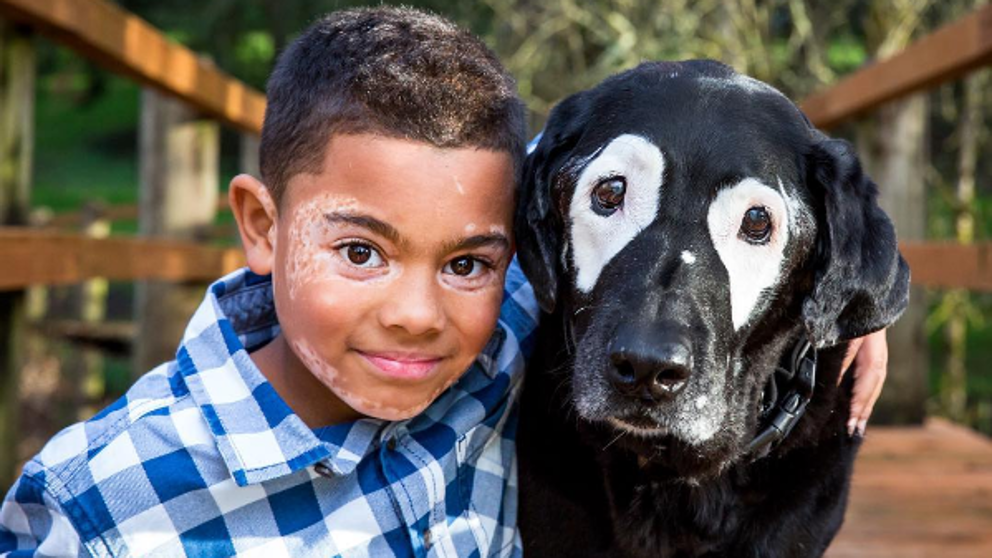 Un ni&ntilde;o sale de la depresi&oacute;n al conocer a un perro con su misma enfermedad