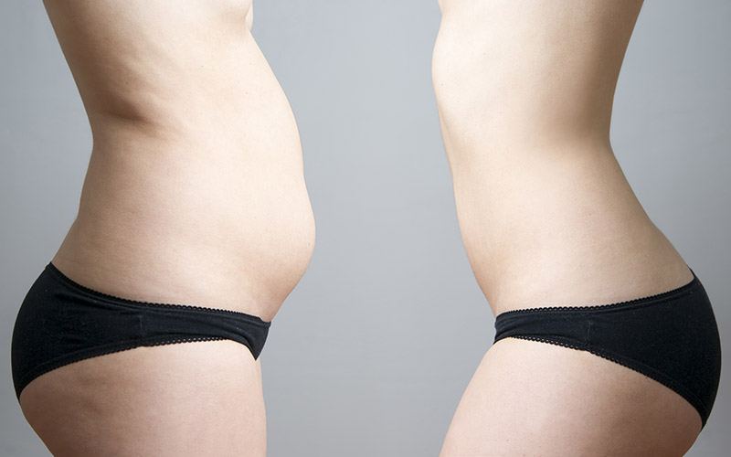 5 Soups that flush inflammation and belly fat