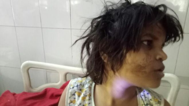 Una ni&ntilde;a fue hallada viviendo con monos 