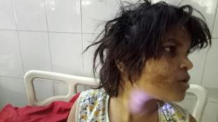 Una ni&ntilde;a fue hallada viviendo con monos 