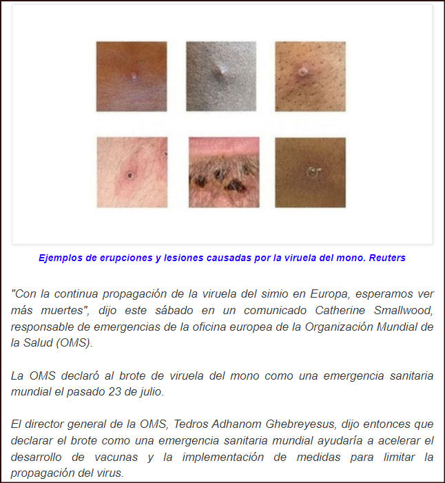 &iquest;Qu&eacute; sabemos de la viruela del mono y de cuantas muertes cuenta en su haber?