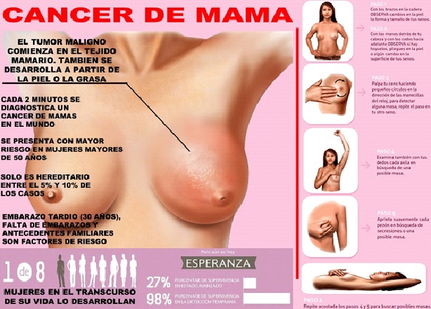 &iquest;Sabes realmente c&oacute;mo detectar el c&aacute;ncer de seno y sus s&iacute;ntomas?