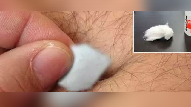 Poniendo esto en el ombligo sanar&aacute; la tos, resfriado, fiebre y c&oacute;licos
