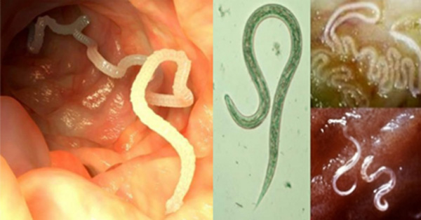 Ingredientes clave que matan de manera efectiva los par&aacute;sitos internos!