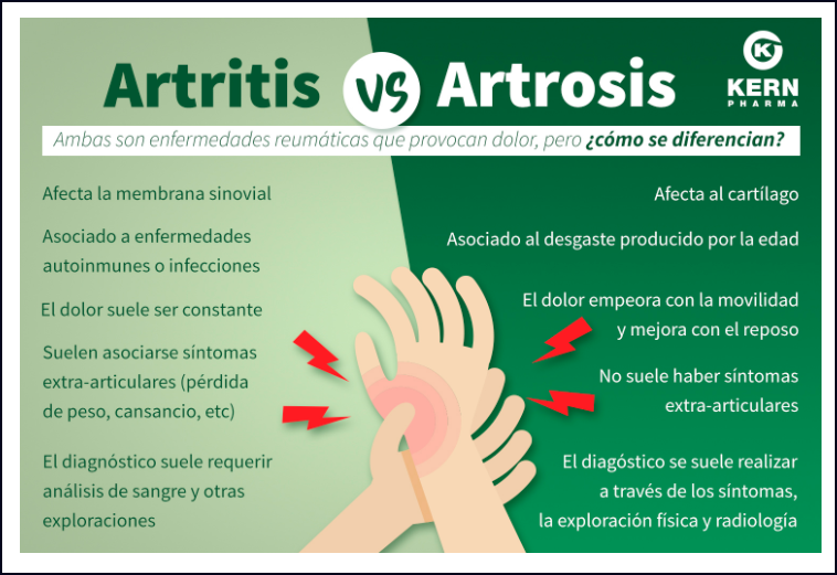 Aqu&iacute; dejo las diferencias entre artrosis y artritis