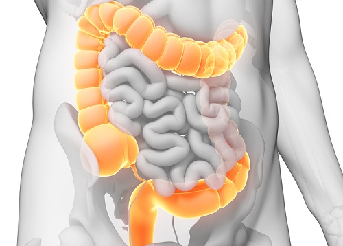 C&oacute;mo hacer una limpieza de colon