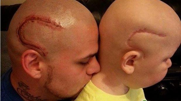 Padre se tatu&oacute; una cicatriz para animar a su hijo con c&aacute;ncer: