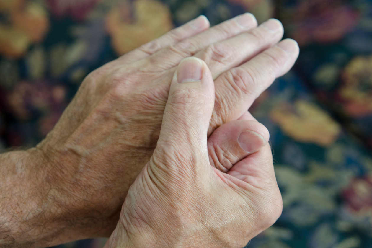 Calma los s&iacute;ntomas de la artritis en las manos con estos remedios naturales