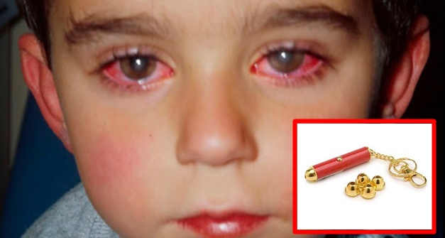 Este ni&ntilde;o perdi&oacute; el 75% de la vista por un juguete que probablemente tenga en casa