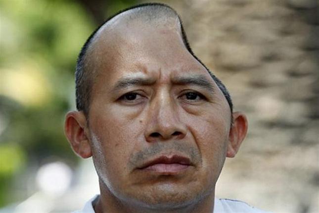PERDI&Oacute; PARTE DE SU CR&Aacute;NEO: LO INDEMNIZARON CON US$ 58 MILLONES