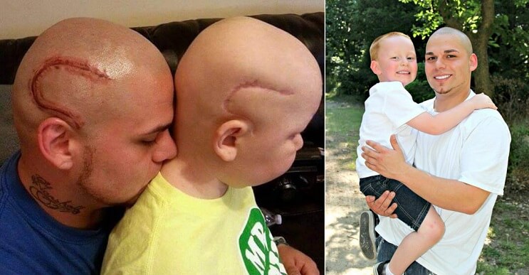 Muri&oacute; el ni&ntilde;o cuyo padre se tat&uacute;o una cicatriz como la suya en la cabeza 