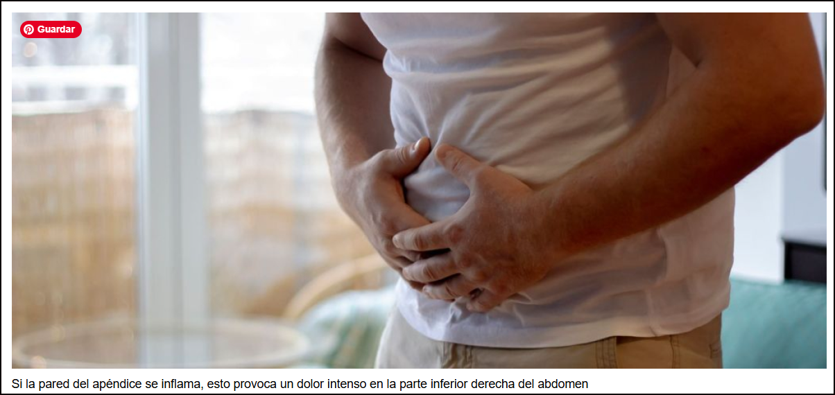  La extirpaci&oacute;n del ap&eacute;ndice puede evitar el c&aacute;ncer colorrectal (nueva investigaci&oacute;n)
