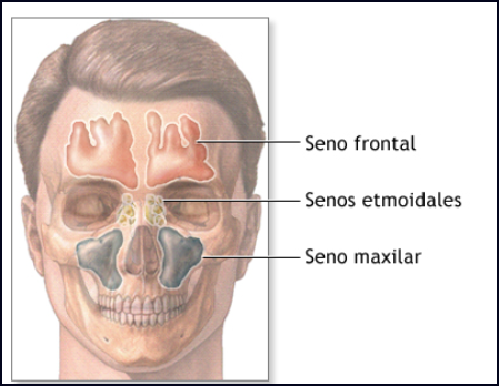 25 d&iacute;as con mucosidad densa y obstructiva, dolor en los p&oacute;mulos ... etc. &iquest;Tengo sinusitis?